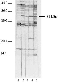 2126 BAYAT et al.: Rev1 MONOCLONAL ANTIBODY PRODUCTION Fig. 2. Antibody responses detected by immunoblotting of B.