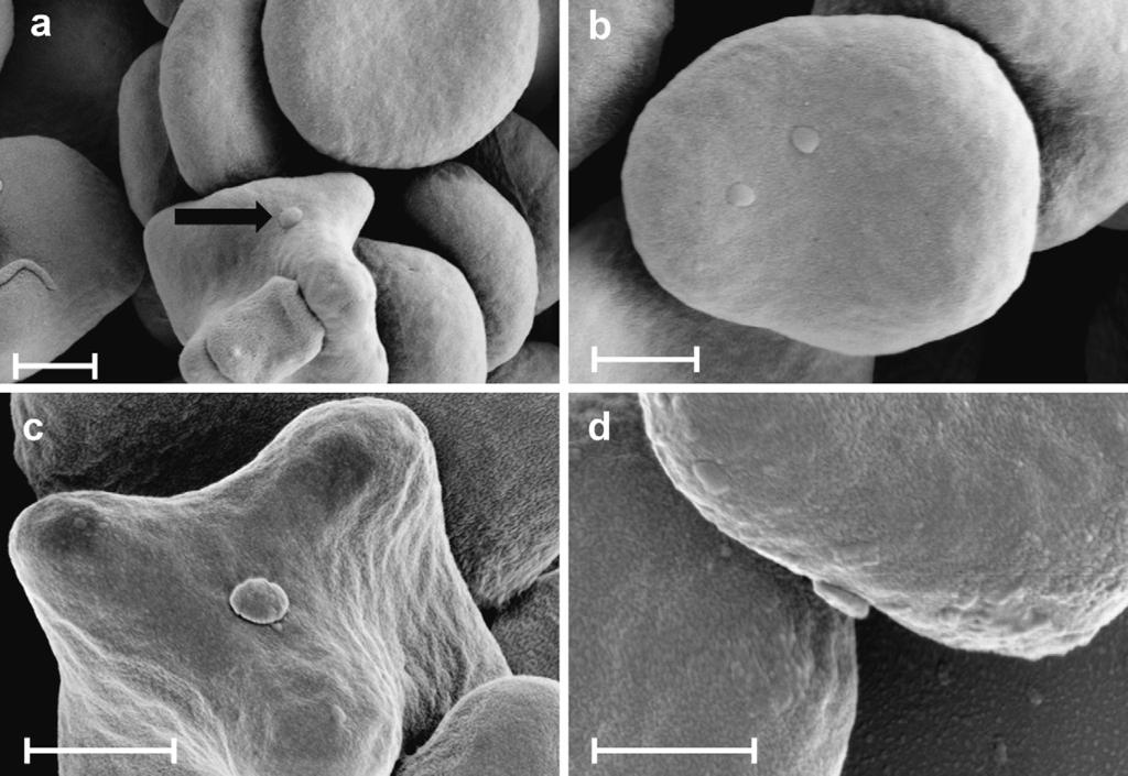 B. Willi et al. / Veterinary Microbiology 149 (2011) 367 373 369 Fig. 1. (a d) SEM images of RBCs from blood anticoagulated with Alsever s solution collected from Cat 1 on day 23 after experimental infection with CMt.