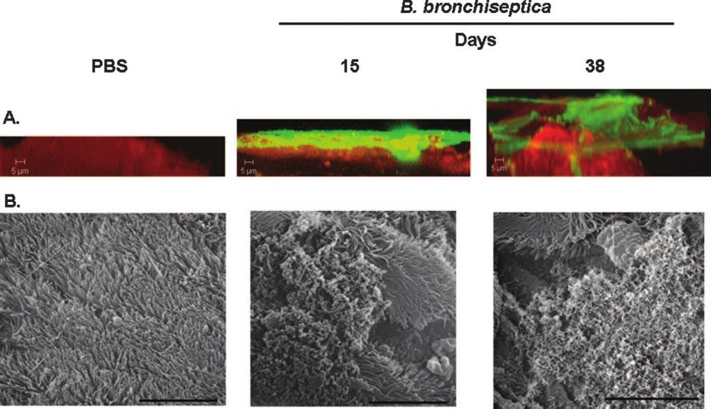 8272 SLOAN ET AL. J. BACTERIOL. FIG. 1. (A) CSLM of biofilms formed within the murine nasal cavity by B. bronchiseptica. C57BL/6 mice were inoculated with either PBS or B. bronchiseptica RB50.