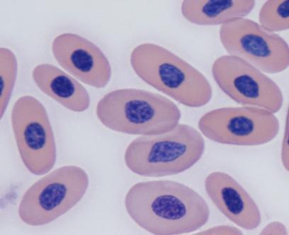 there was sufficient blood collected to only produce smears, the background was more dense, and surrounding the cells, the background was purple to pink.