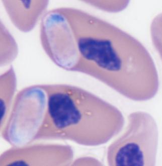 thin capsule, a central area of pink to orange (very similar in colour to the erythrocyte cytoplasm), and a single darker blue nucleus at one pole