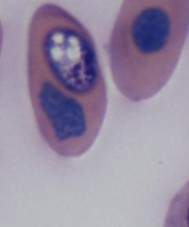 2µm in diameter (n=8) (intraerythrocytic parasites) (Figure 36).