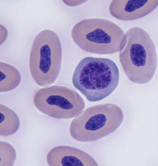 On all smears except one, there were variable numbers of cells consistent with immature erythrocytes or polychromatophils. The stage of polychromatophil was not further distinguished.