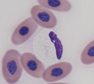 Eosinophils On all smears were a population of nucleated cells which constituted 0-22% of the differential (90% confidence intervals; n=46).
