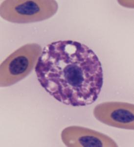 On the smears from two bobtails, very rare, round leukocytes were seen which possessed a low nuclear to cytoplasmic ratio, an eccentric ovoid nucleus, finely clumped chromatin, and a pale cytoplasm