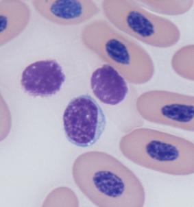 nucleus), plasmacytoid lymphocyte, Mott cell.