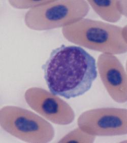 Due to the clumping, thrombocyte counts were not attempted.
