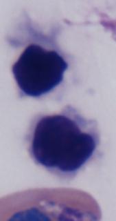 (Wright s-giemsa) Figure 51: Thrombocytes