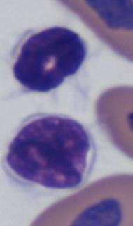 thrombocyte (thin arrow) and a lymphocyte