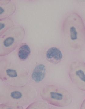 cells); a small thrombocyte clump (thin arrow)