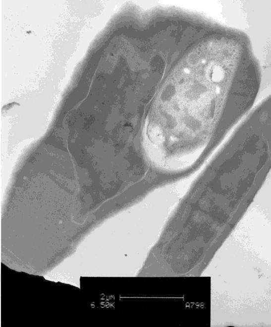 Figure 53: Transmission electron microscope