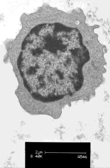 Figure 56: A transmission electron photomicrograph of a lymphocyte with a single small granule in the cytoplasm (arrow).