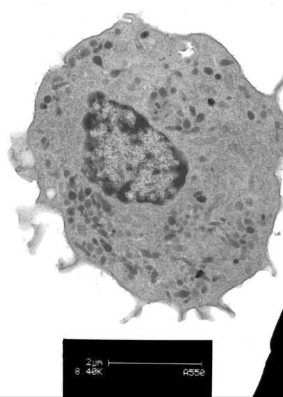 The cytoplasm was medium grey and there were variable numbers of small, moderately electron-dense granules (azurophils), and large numbers of