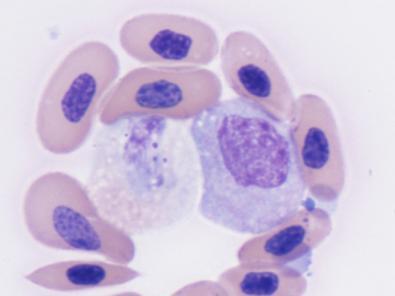 Left- An immature heterophil (left) with mild cytoplasmic basophilia and vacuolation (mild to moderate toxic