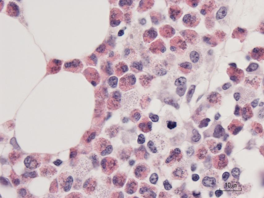 (1000x magnification, Wright s-giemsa) * Figure 68: Bone marrow histology section from the pelvis with predominantly developing heterophils (thin arrow) and admixed eosinophils (thick arrow).