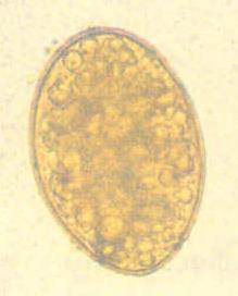 Pseudophyllidea