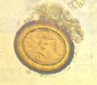 operculum no embryo No