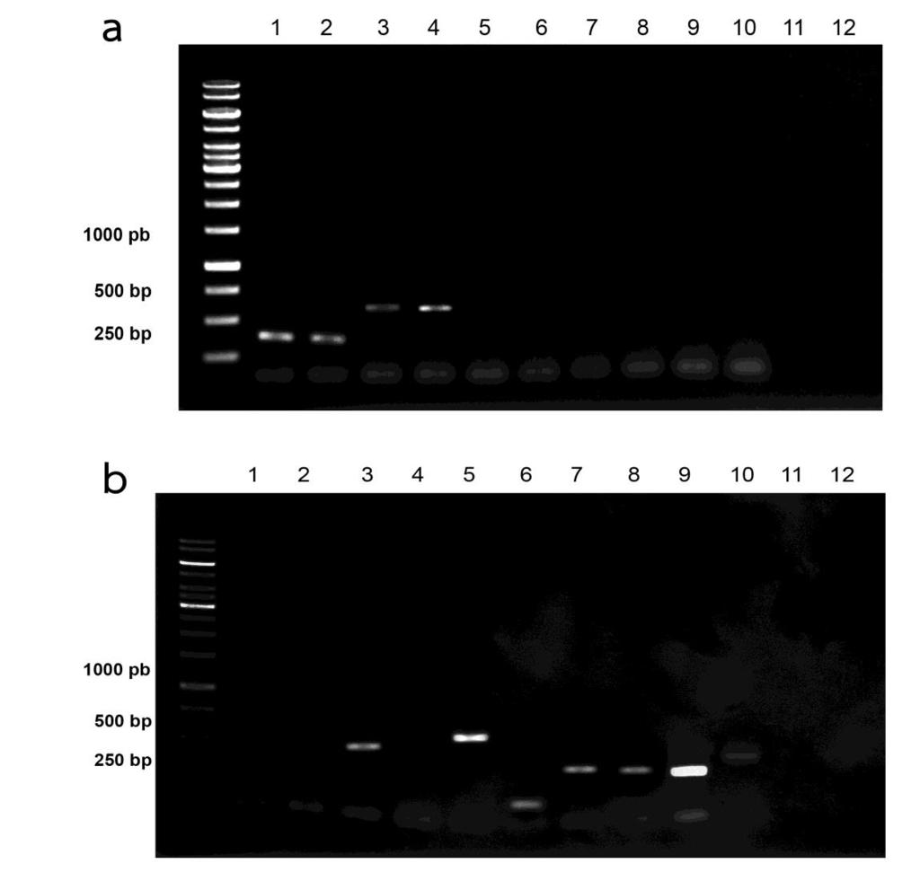 45 Figure 22 Agarose gel eletrophoresis of PCR products using multiplex PCR assays with the primer set 1 (panel A) (a) and 2 (panel B) (b) and DNA extracted from saliva. Lane 1 T. albolabris.