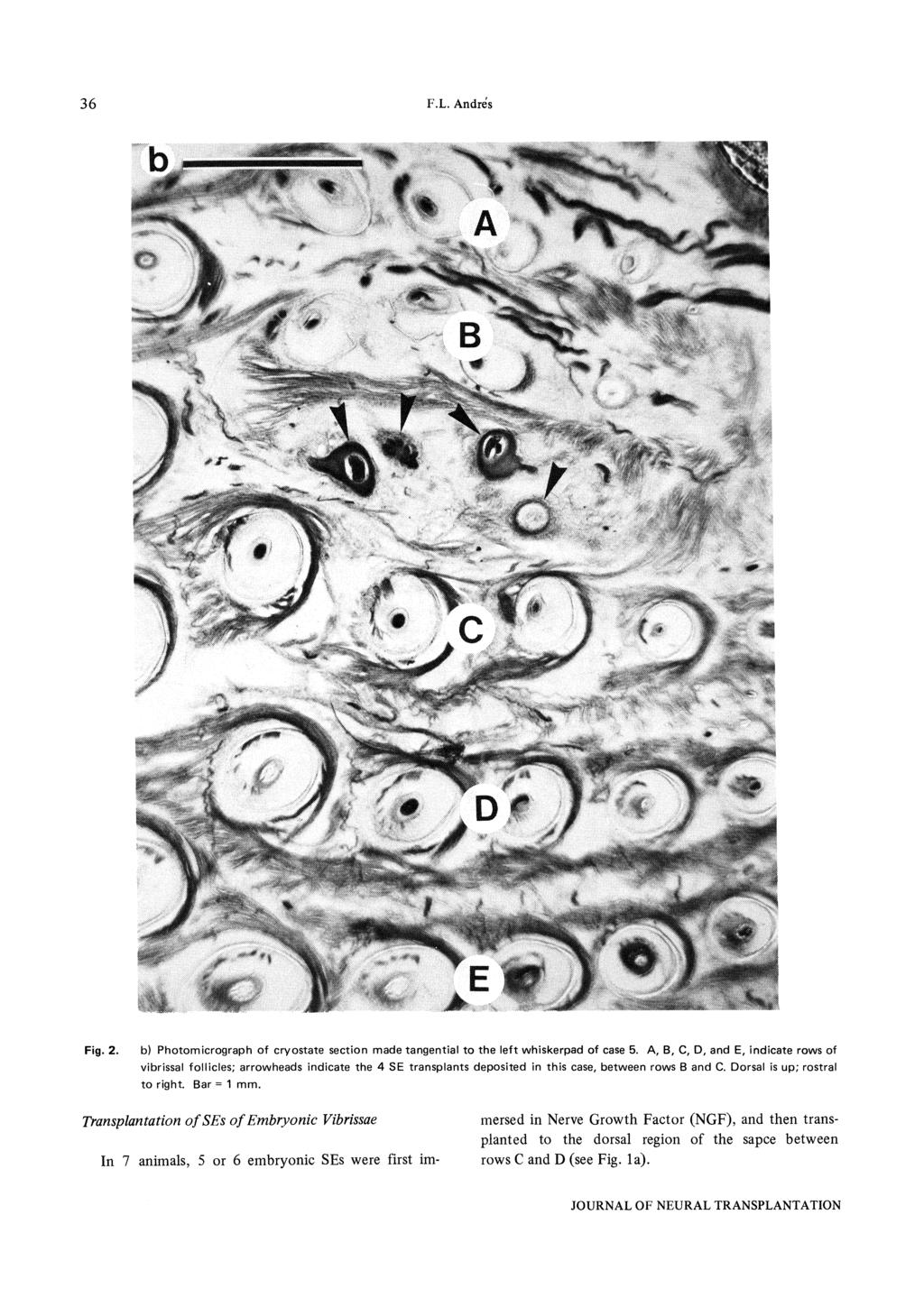 F.L. Andrds 36 Fig. 2. b) Photomicrograph of cryostate section made tangential to the left whiskerpad of case 5.