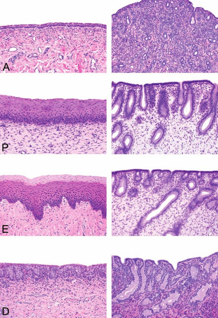 946 CHANDRA AND ADLER TOXICOLOGIC PATHOLOGY FIGURE 2. Typical morphological features of the vaginal mucosa and endometrium in anestrus (A), proestrus (P), estrus (E), and early diestrus (D). H&E.