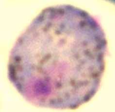 Microscopic appearance of gametocytes Giemsa Staining: Mature FEMALE Gametocyte: eccentric (compact) nucleus, scattered pigment granules and blue