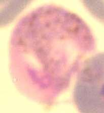 Mature MALE Gametocyte: large nucleus (red DNA spot in a large pink areola) at the edge of the cell, scattered pigment granules and pink staining
