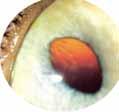in cats Definition Loss of variable amounts of corneal epithelium or/and stroma 67 68 Causes of corneal ulcers (in cats) Trauma Herpetic keratitis Classification Superficial ulceration Stromal