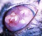 Long term seqeula: synechia, glaucoma, cataract.