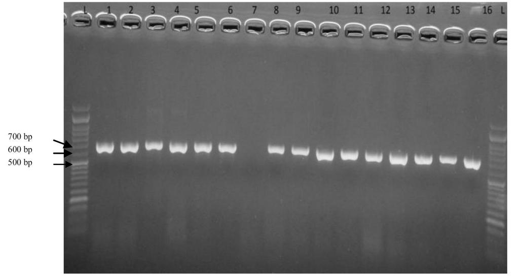Figure 1: Evaluation of Escherichia coli Eco gene using PCR and assessed by agarose gel electrophoresis. L: 50 bp DNA ladder; lane 1: E.