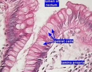 intestine, FCoVs spread to infect