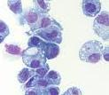 FCoV RT-PCR test ( blood/effusion fluid/feces) Blood FCoV RT-PCR FECV Monocyte-associated viremia?