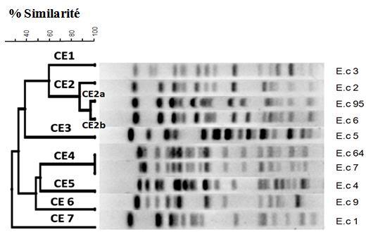 Typing of ESBL E. coli by pulsed-field electrophoresis: clonal diffusion?