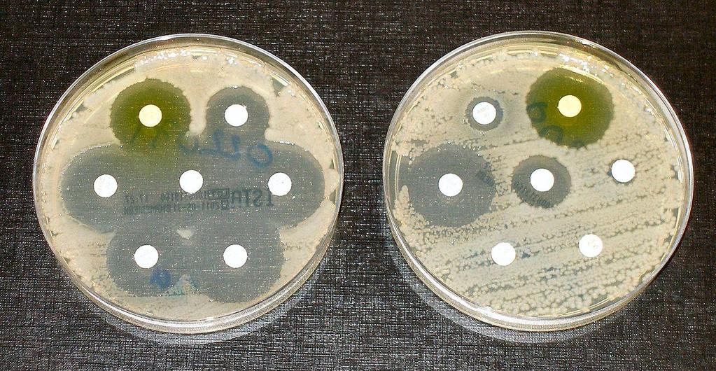 Same species of bacteria on the left and the right, but the one on the