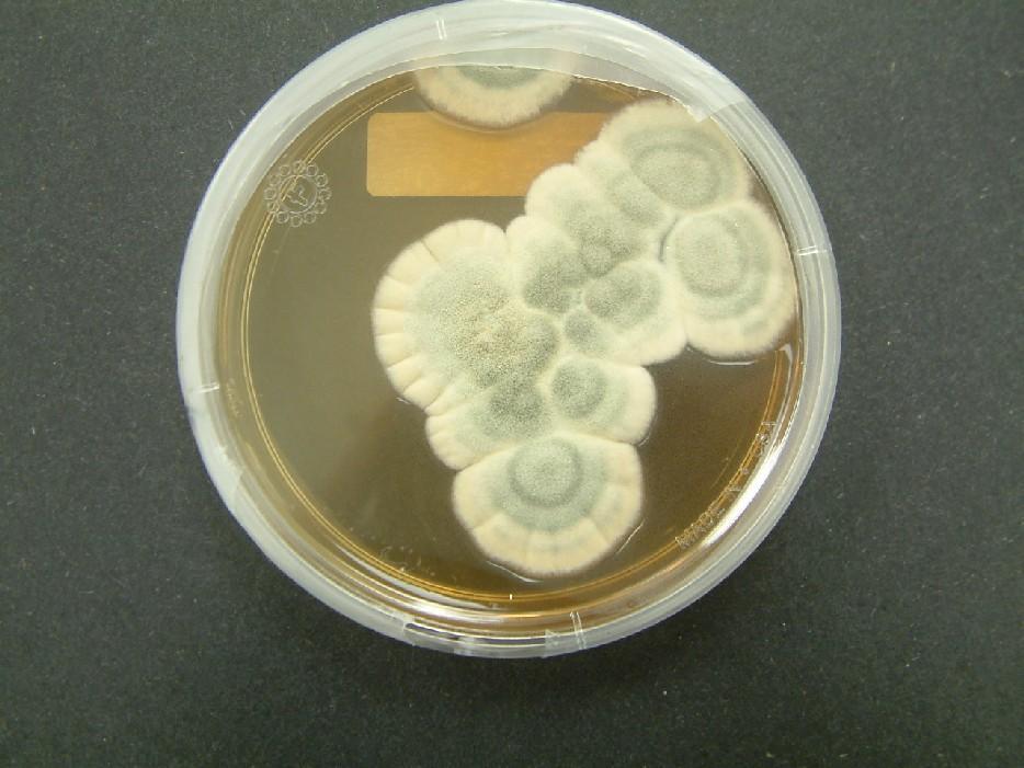 Antibiotic Resistance The antibiotic properties of plants and certain fermented foods have been recognized for thousands