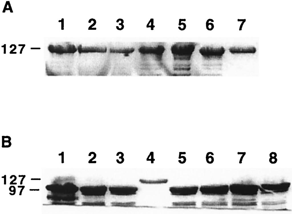 Isolates were recovered from placentae (lanes 1, 2, and 4) and fetal livers (lanes 3, 5, and 6). The challenge strain is shown in lane 7. Sizes are indicated in kilodaltons.