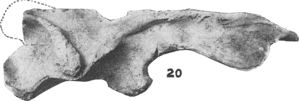 The parieto-squamosal arcade is crushed and largely broken away, giving an appearance to the supratemporal fenestra much like that of Mystriosuchus planirostrus.
