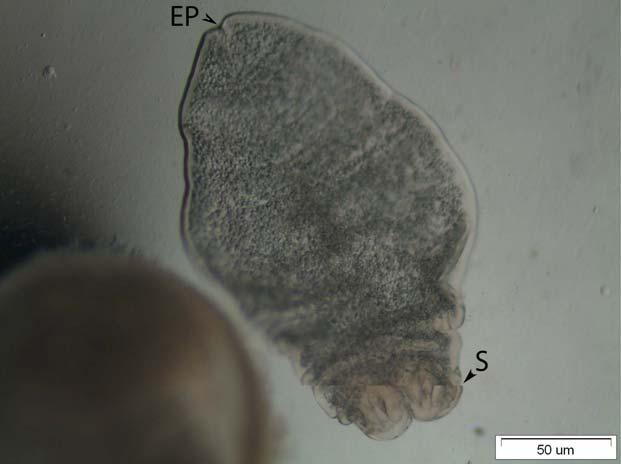 isolated from the infected liver of a Anatolian Lizard. (S) Tetra-acetabulate scolex. Figure no.