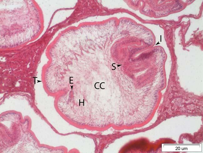 First Record of Mesocestoides spp. in Anatolian lizard 101 cation of the proliferous tetrathyridia (Mesocestoides spp.) in an experimentally infected reptilian host.