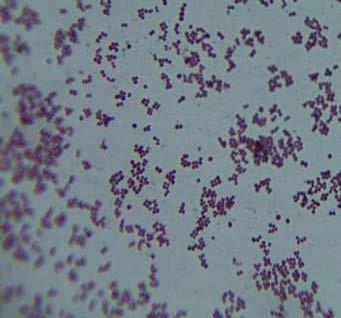Fig. 2: Staphylococcus aureus after Gram s staining (a) (b) Fig.