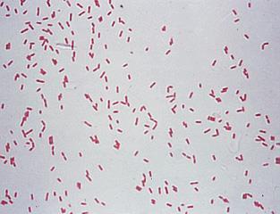 Pseudomonas aeruginosa is a nonfermentative gram negative bacillus. Characterized by the production of pyocyanin.