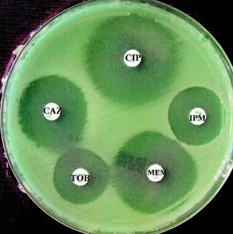 Results Biochemical test Clinical case Oxidase + + (OF) + + Catalase + ------ Microbiology laboratory SIM ----- Movility (+) Production H2S (-) Production Indol (-) Picture 1: results obtained at the