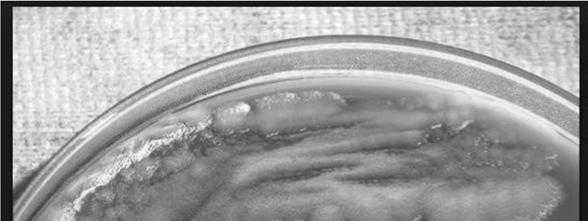 Bacillus diagnosis : blood agar: (medusa head) grey wavy with projections Gram stain: