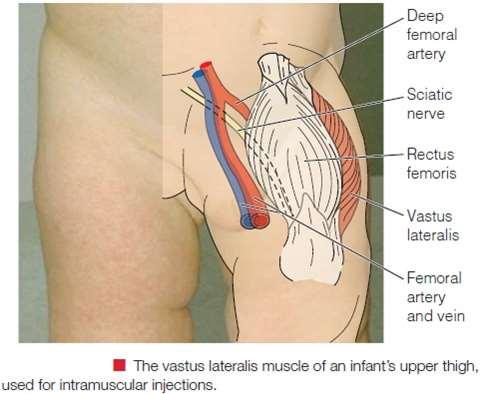 A. Intravenous (IV) Injections: