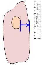 Measurement of Lesions Measurement for All Lesions Head-to-toe vs largest perpendicular width