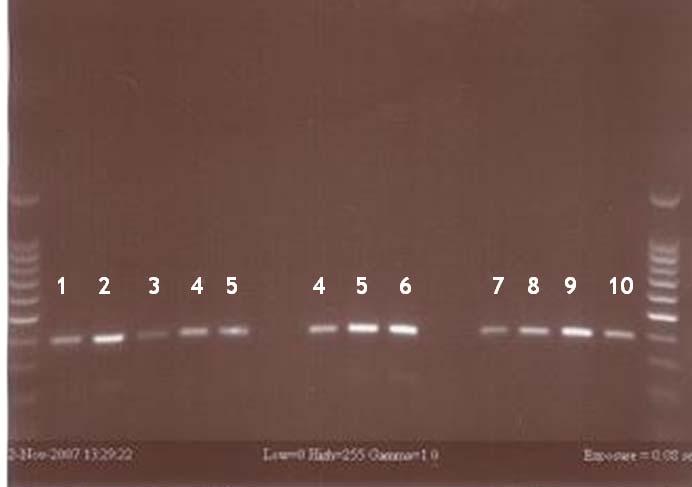 Separation on 1% agarose 0.5xTBE agarose gel of products yielded from an RT-PCR with primer adrenal LHR-B carcinoma and cdna.