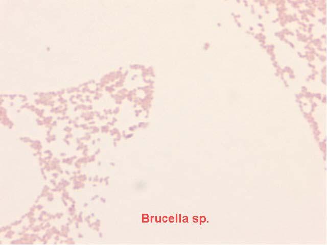 Brucellosis Agent: Brucella abortus, Brucella melitensis, Brucella suis, and Brucella canis Aerosols of Brucella spp. are considered to be highly infectious. B. melitensis produces the most severe and acute form of disease.