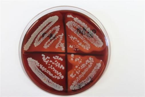 LF RF LR RR Figure 15. TSA 5% blood agar plate illustrating a heifer with 3 S. aureus-infected quarters (RF, LF, RR) identified by the β-hemolysis and 1 CNS-infected quarters (LR).