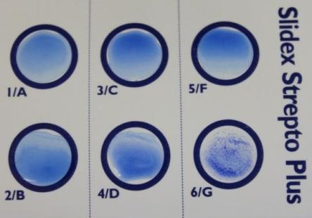 was visible (Figure 19). If there was agglutination in an ungroupable antigen category or no agglutination at all, an API 20 Strep test (biomérieux, Marcy l'etoile, France) was conducted.
