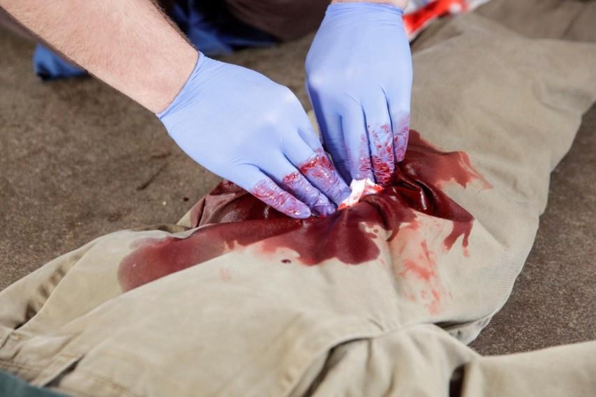 Wound Packing (4 of 5) Quickly apply and hold pressure directly on the packed wound until relieved by medical responders If initial packing and direct pressure fail