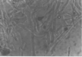 many large, ellipsoidal thin-walled microconidia with four to five cells